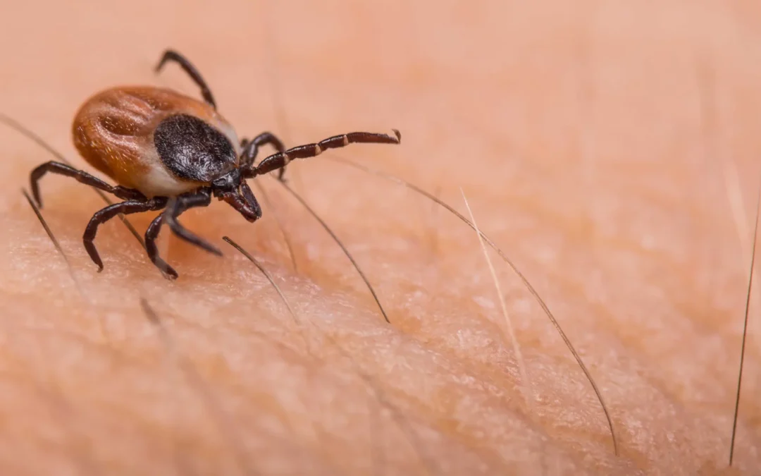 What you need to know to stay safe from Lyme disease this summer
