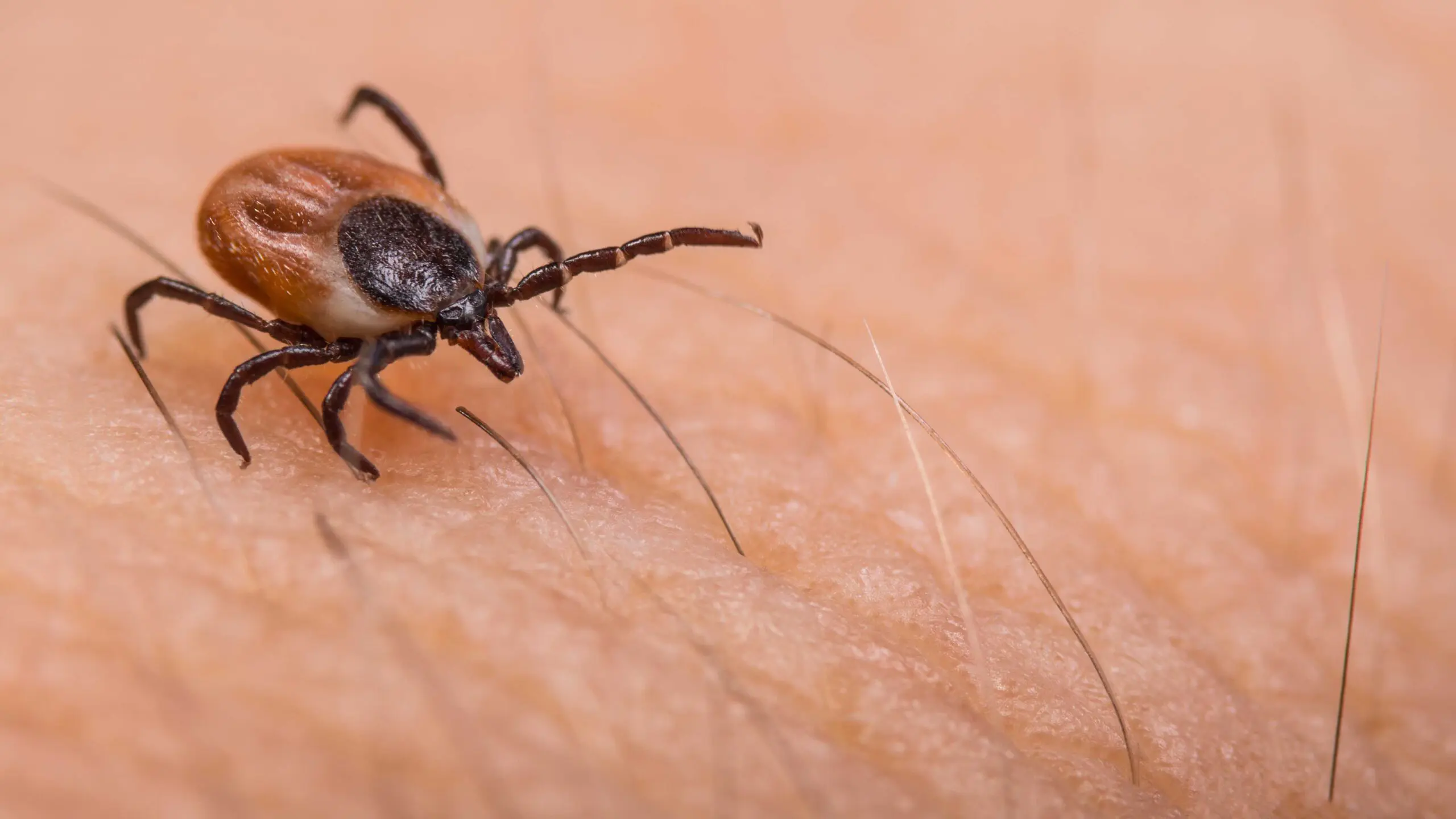 What you need to know to stay safe from Lyme disease this summer