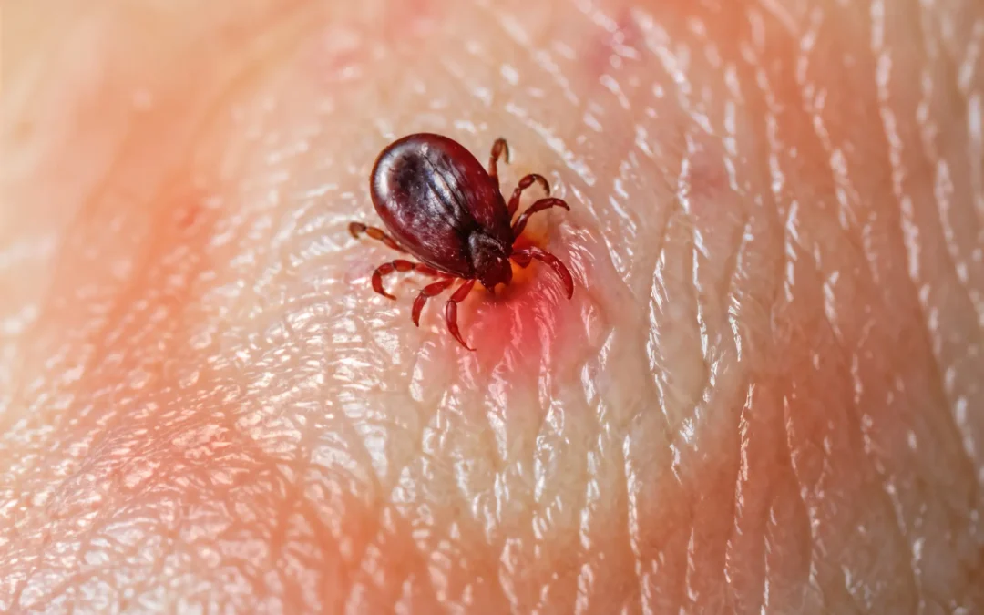Dogs can get a Lyme disease vaccine. Why can’t humans?