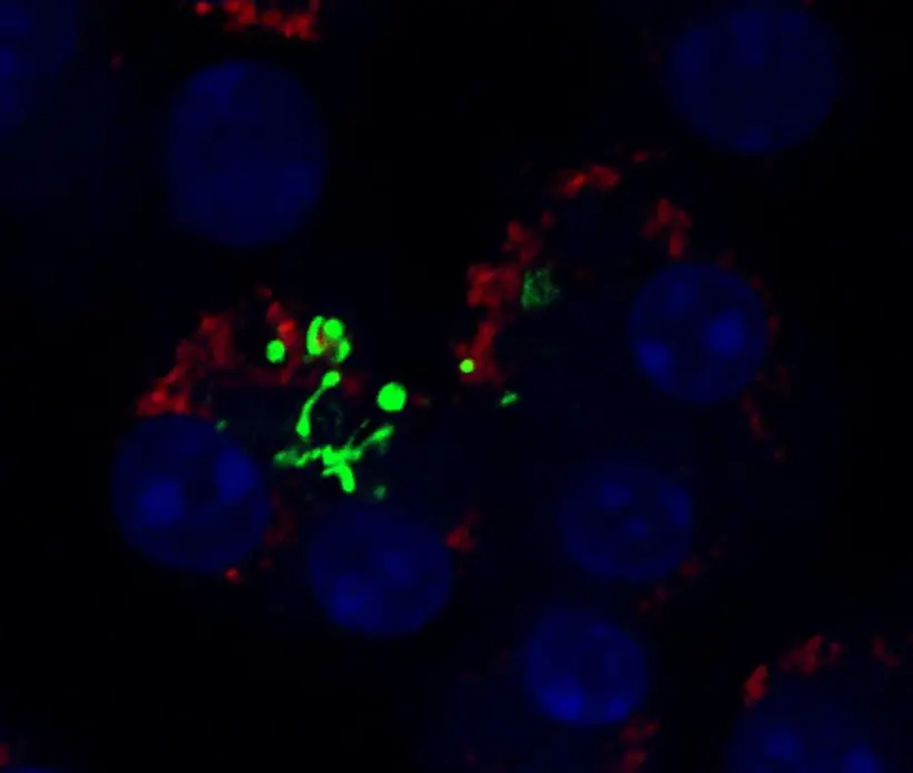 Tufts Lyme Disease Initiative receives $7 million in new grants