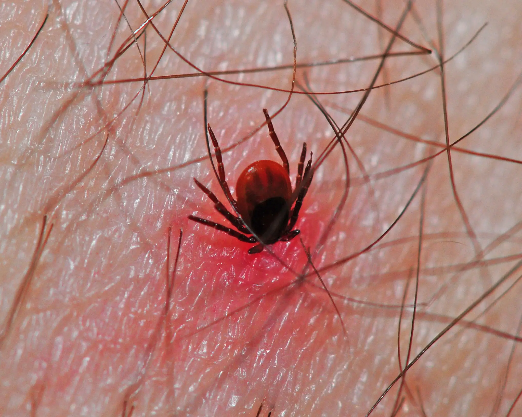 A Pill That Kills Ticks Is a Promising New Weapon Against Lyme Disease